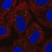 Anti-KRT222 antibody produced in rabbit Prestige Antibodies&#174; Powered by Atlas Antibodies, affinity isolated antibody, buffered aqueous glycerol solution