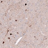 Monoclonal Anti-SST antibody produced in mouse Prestige Antibodies® Powered by Atlas Antibodies, clone CL15076, purified antibody (Protein A)