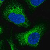 Anti-DNAJC3 antibody produced in rabbit Prestige Antibodies&#174; Powered by Atlas Antibodies, affinity isolated antibody, buffered aqueous glycerol solution