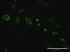 Monoclonal Anti-40429 antibody produced in mouse clone 1G3-7D1, purified immunoglobulin, buffered aqueous solution