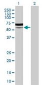 Anti-PIK3R5 antibody produced in rabbit purified immunoglobulin, buffered aqueous solution