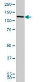 Monoclonal Anti-CHERP antibody produced in mouse clone 2H5, purified immunoglobulin, buffered aqueous solution