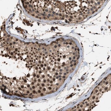 Anti-DENND6B antibody produced in rabbit Prestige Antibodies&#174; Powered by Atlas Antibodies, affinity isolated antibody, buffered aqueous glycerol solution, Ab1