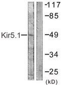 Anti-Kir5.1 antibody produced in rabbit affinity isolated antibody