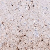 Monoclonal Anti-CRYAB antibody produced in mouse Prestige Antibodies® Powered by Atlas Antibodies, clone CL10765, purified antibody (Protein A)