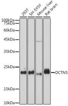 Anti-DCTN5 Antibody, clone 9W2S4, Rabbit Monoclonal