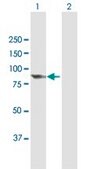 抗 PCIF1 小鼠抗 purified immunoglobulin, buffered aqueous solution