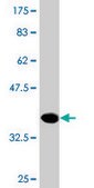 Monoclonal Anti-NME3, (C-terminal) antibody produced in mouse clone 3G10, purified immunoglobulin, buffered aqueous solution