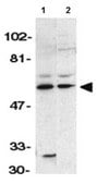 Anti-RICK Antibody from rabbit, purified by affinity chromatography