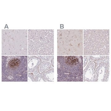 Anti-TMEM119 antibody produced in rabbit Prestige Antibodies&#174; Powered by Atlas Antibodies, affinity isolated antibody, buffered aqueous glycerol solution