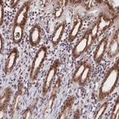 Anti-DNAJC17 antibody produced in rabbit Prestige Antibodies&#174; Powered by Atlas Antibodies, affinity isolated antibody, buffered aqueous glycerol solution