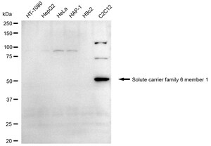 Anti Solute Carrier Family 6 Member 1 Antibody, clone 24GB2390, Rabbit Monoclonal clone 24GB2390, recombinant rabbit monoclonal, expressed in HEK293 cells