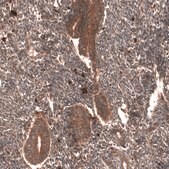 Monoclonal Anti-Yap1 Antibody Produced In Mouse Prestige Antibodies&#174; Powered by Atlas Antibodies, clone CL13628, affinity isolated antibody, buffered aqueous glycerol solution