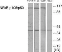 Anti-NF-&#954;B p105 antibody produced in rabbit affinity isolated antibody