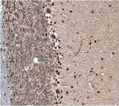 Anti-CAPS-2 Antibody from rabbit, purified by affinity chromatography