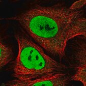 Anti-CDC26 antibody produced in rabbit Prestige Antibodies® Powered by Atlas Antibodies, affinity isolated antibody, buffered aqueous glycerol solution