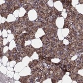 Anti-TESC antibody produced in rabbit Prestige Antibodies&#174; Powered by Atlas Antibodies, affinity isolated antibody, buffered aqueous glycerol solution