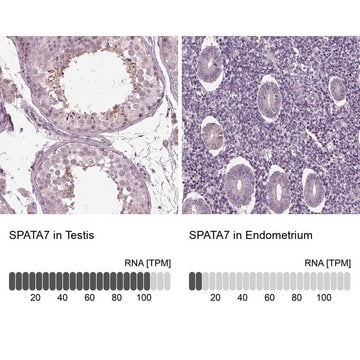 Anti-SPATA7 antibody produced in rabbit Prestige Antibodies&#174; Powered by Atlas Antibodies, affinity isolated antibody, buffered aqueous glycerol solution