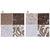 Anti-YARS antibody produced in rabbit Prestige Antibodies&#174; Powered by Atlas Antibodies, affinity isolated antibody, buffered aqueous glycerol solution