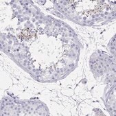 Anti-ARMC12 antibody produced in rabbit Prestige Antibodies&#174; Powered by Atlas Antibodies, affinity isolated antibody, buffered aqueous glycerol solution