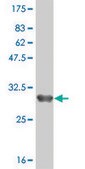 Monoclonal Anti-ZDHHC8 antibody produced in mouse clone 1C5, purified immunoglobulin, buffered aqueous solution