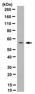 Anti-RAG-2 Antibody, clone 39 culture supernatant, clone 39, from rabbit