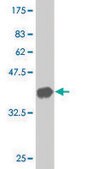 Monoclonal Anti-TG antibody produced in mouse clone 1G3, purified immunoglobulin, buffered aqueous solution