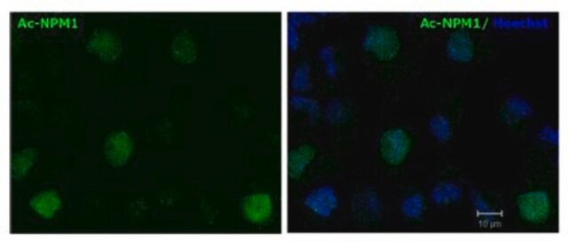 Anti-Acetylated Nucleophosmin Antibody, clone 31M1 clone 31M1, from mouse