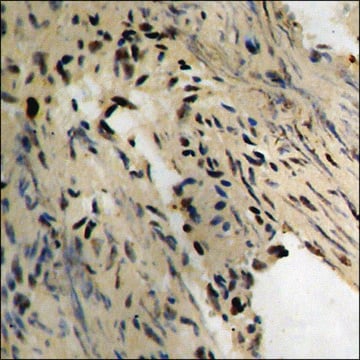 Anti-phospho-Tau (pThr231) antibody produced in rabbit affinity isolated antibody