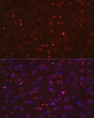 Anti-STAT3 antibody produced in rabbit