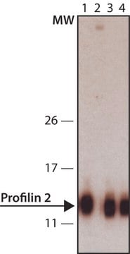 Anti-Profilin 2 (C-terminal) 兔抗 IgG fraction of antiserum, buffered aqueous solution