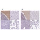 Anti-SYT1 antibody produced in rabbit Prestige Antibodies® Powered by Atlas Antibodies, affinity isolated antibody, buffered aqueous glycerol solution