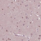 Anti-CLCN4 antibody produced in rabbit Prestige Antibodies&#174; Powered by Atlas Antibodies, affinity isolated antibody, buffered aqueous glycerol solution