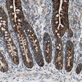 Anti-CPT1A antibody produced in rabbit Prestige Antibodies® Powered by Atlas Antibodies, affinity isolated antibody, buffered aqueous glycerol solution