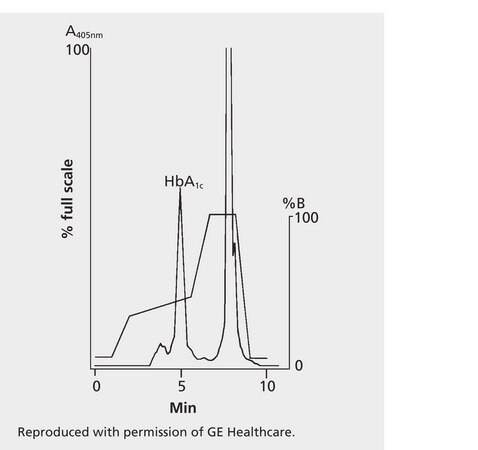 HPLC Analysis of Hemoglobin HbA1C on Mono S® HR5/5 application for HPLC
