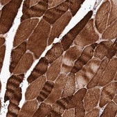 Anti-REXO2 antibody produced in rabbit Prestige Antibodies&#174; Powered by Atlas Antibodies, affinity isolated antibody, buffered aqueous glycerol solution