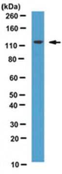Anti-hRNF20 Antibody from rabbit, purified by affinity chromatography