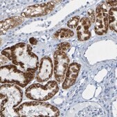 Anti-ACMSD antibody produced in rabbit Prestige Antibodies&#174; Powered by Atlas Antibodies, affinity isolated antibody, buffered aqueous glycerol solution