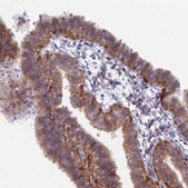Anti-B9D2 antibody produced in rabbit Prestige Antibodies&#174; Powered by Atlas Antibodies, affinity isolated antibody, buffered aqueous glycerol solution