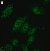 Anti-HDAC4 Antibody, clone 1C16 ZooMAb&#174; Rabbit Monoclonal recombinant, expressed in HEK 293 cells