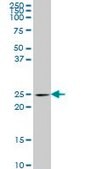 Monoclonal Anti-PCMT1 antibody produced in mouse clone 4G9, purified immunoglobulin, buffered aqueous solution