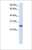 Anti-PRDX1 antibody produced in rabbit affinity isolated antibody