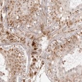 Anti-TCTEX1D1 antibody produced in rabbit Prestige Antibodies&#174; Powered by Atlas Antibodies, affinity isolated antibody, buffered aqueous glycerol solution