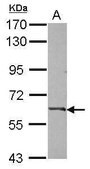 Anti-C9 antibody produced in rabbit affinity isolated antibody, buffered aqueous solution