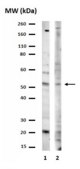 Anti-ALK7 Antibody Upstate®, from rabbit