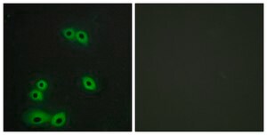 Anti-MUC1 antibody produced in rabbit affinity isolated antibody