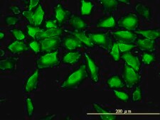 Monoclonal Anti-ACY1 antibody produced in mouse clone 4F1-B7, purified immunoglobulin, buffered aqueous solution