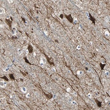 Anti-JADE3 antibody produced in rabbit Prestige Antibodies&#174; Powered by Atlas Antibodies, affinity isolated antibody, buffered aqueous glycerol solution