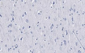 Anti-Catenin-α 2 Antibody, clone 3F7 ZooMAb® Rabbit Monoclonal recombinant, expressed in HEK 293 cells