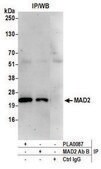 Rabbit anti-MAD2 Antibody, Affinity Purified Powered by Bethyl Laboratories, Inc.